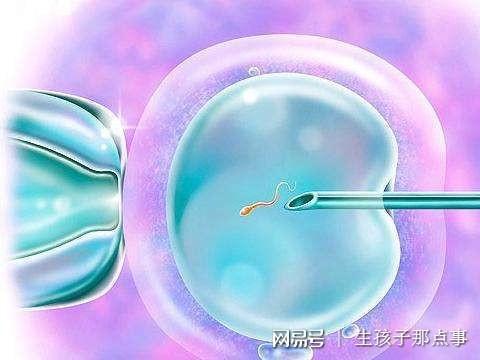 孕检