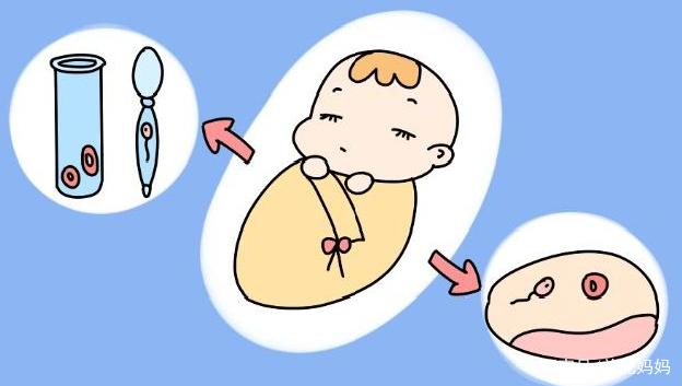胚胎移植