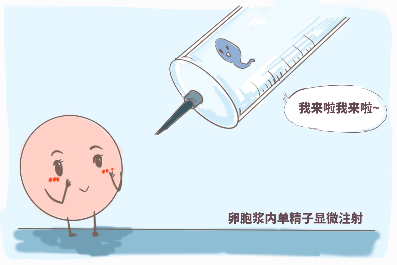 器官移植