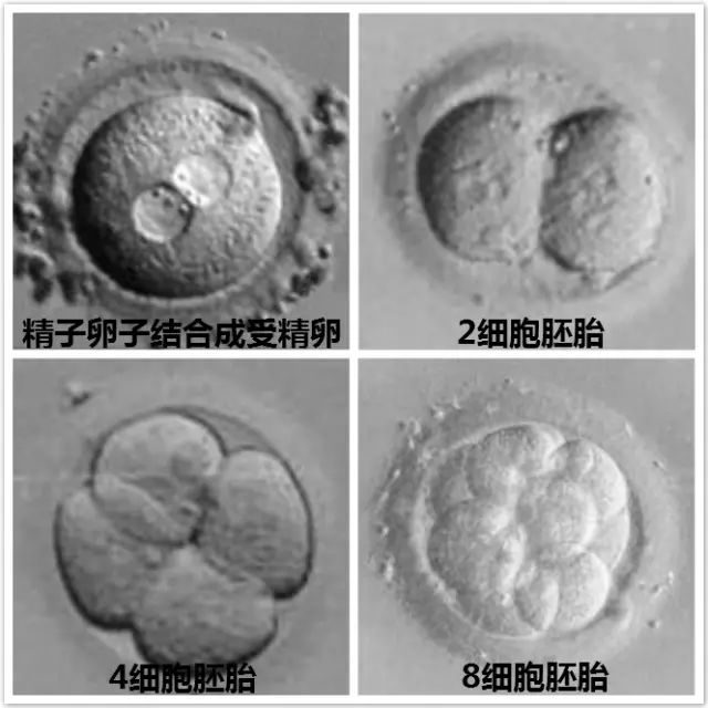 孕检