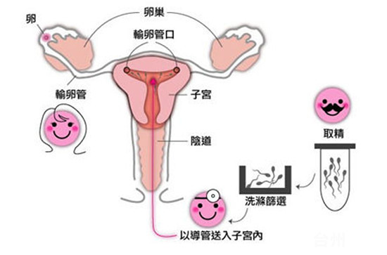 胚胎移植