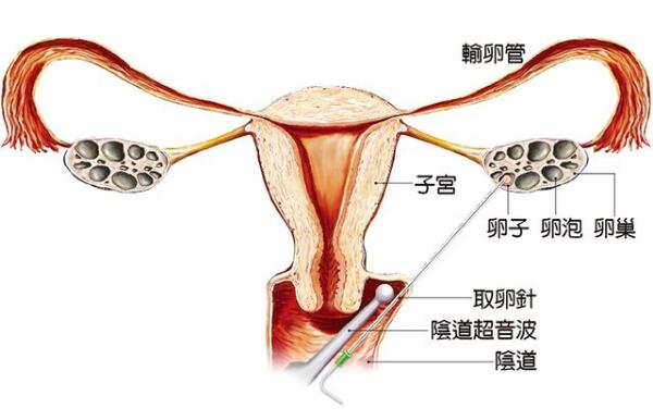 经期戴套同房