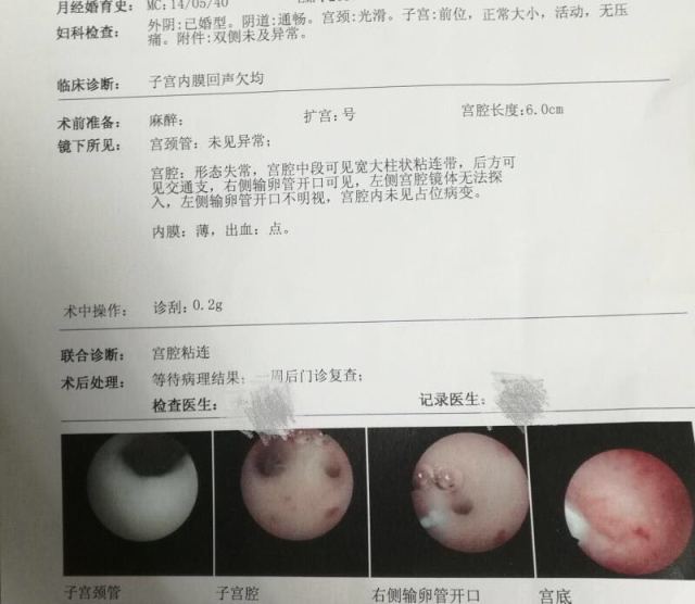 婚后未孕