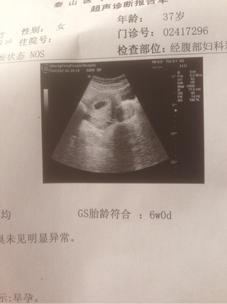经期血块特多