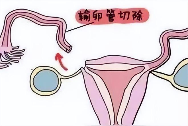 月经期
