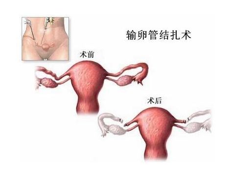 月经规律